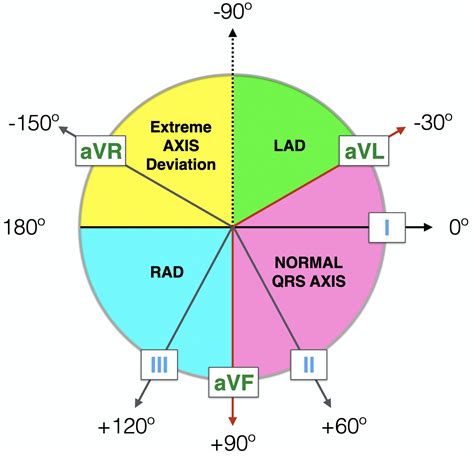 right axis deviation normal range